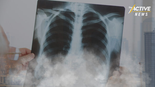 คนไทยป่วย “มะเร็งปอด” ตายอันดับ 2 โยงปัญหาฝุ่น PM2.5