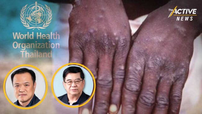 วัคซีนฝีดาษลิง: ต้องเร่งจัดหา หรือยังไม่จำเป็น ?