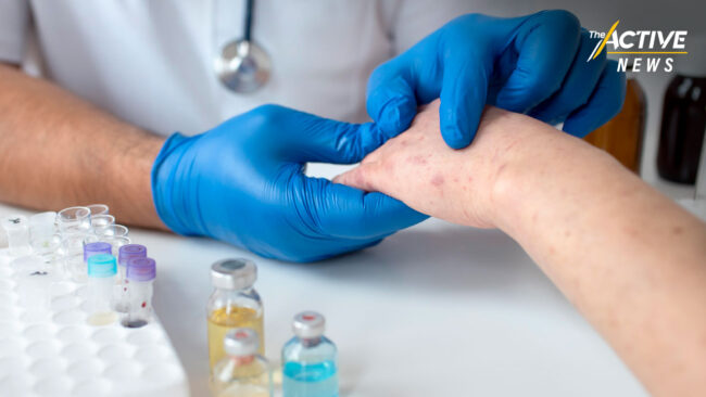 แนะ สธ. เตรียมวัคซีนฝีดาษลิงรุ่นใหม่ ชี้ เคสจะเพิ่มขึ้นเรื่อย ๆ