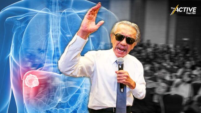 ชูวิทย์ ป่วย “มะเร็งตับ”​ เช็คอาการโรคที่พบมากเป็นอันดับ 1 ของคนไทย