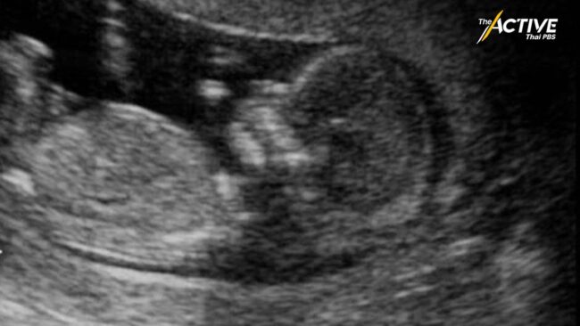 'เกิด' ต้องไม่เป็นภาระครอบครัว สช. เร่งสร้างระบบรองรับ