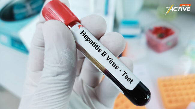 เร่งคัดกรอง 'ไวรัสตับอักเสบ บี,ซี' สกัดผู้ป่วยมะเร็งตับรายใหม่