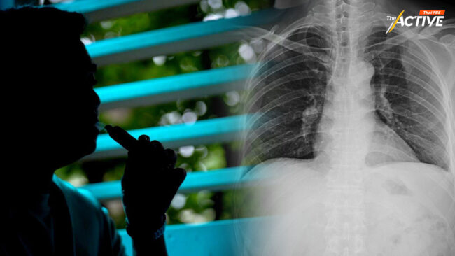 'บุหรี่ไฟฟ้า' สู่ความเสี่ยง 'ปอดอักเสบ' สธ. สั่งเก็บข้อมูลผู้ป่วยทุก รพ.