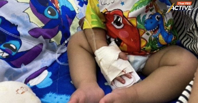 มองกรณี ผช.พยาบาล ตัดนิ้ว “น้องยูฟ่า” ค้นหาจุดอ่อนระบบ วิเคราะห์ปัจจัยปิดความเสี่ยงไม่ปลอดภัย